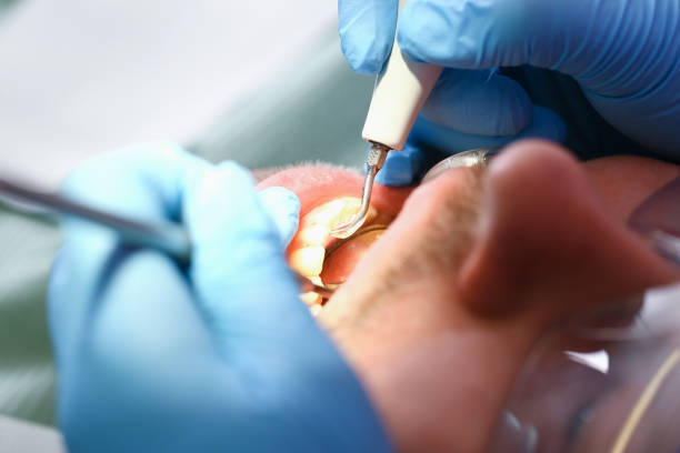 Best Pediatric Emergency Dentist in Buchanan Dam, TX
